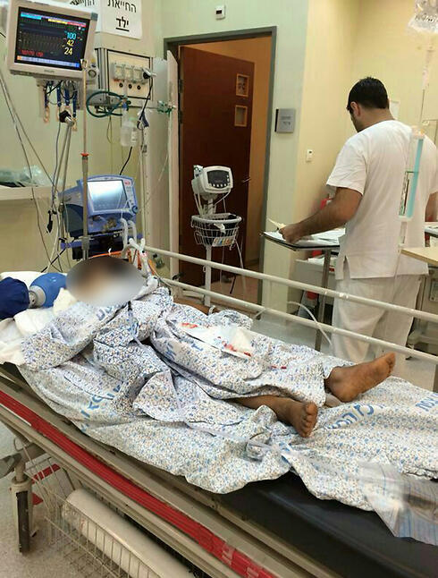 A wounded Syrian boy being treated at Ziv Medical Center (Photo: Courtesy) (צילום: המרכז הרפואי זיו בצפת) A wounded Syrian boy being treated at Ziv Medical Center (Photo: Courtesy)