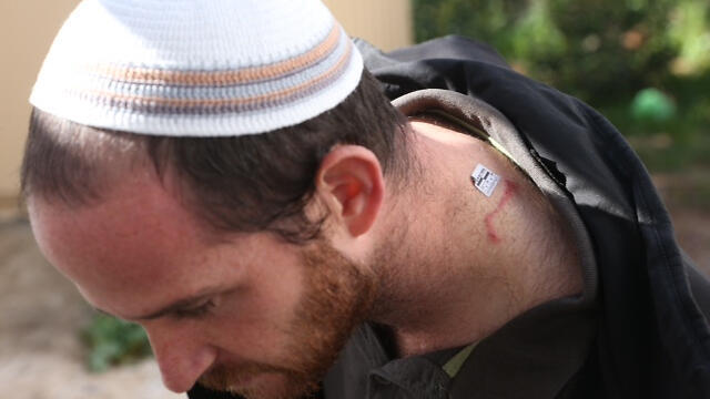 Josh Lorech sustained light wounds after being stabbed by female terrorist in West Bank. (Photo: Motti Kimchi) (צילום: מוטי קמחי ) Josh Lorech sustained light wounds after being stabbed by female terrorist in West Bank. (Photo: Motti Kimchi)