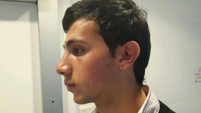 Tommy Hasson after the attack.