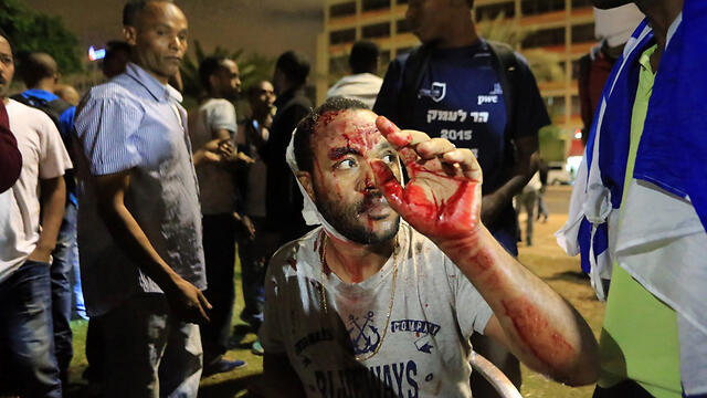 A wounded protester in Rabin Square (Photo: Yaron Brenner) (צילום: ירון ברנר) A wounded protester in Rabin Square (Photo: Yaron Brenner)