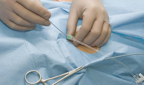 Шунтирование. Фото: shutterstock (צילום: shutterstock) Шунтирование. Фото: shutterstock