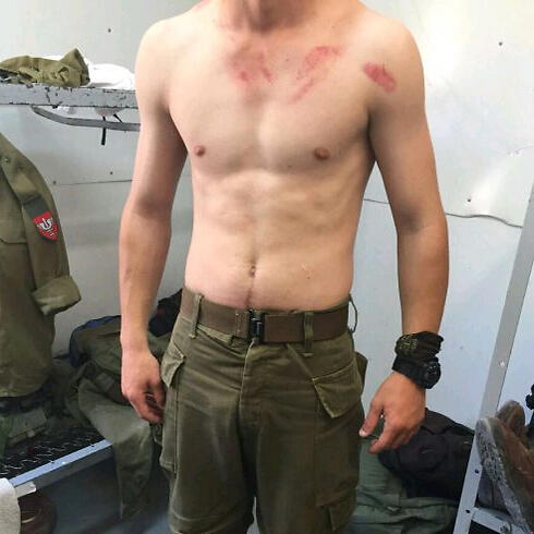 The soldier's self-inflicted injuries (Photo: Israeli Christians Recruitment Forum) (צילום: פורום גיוס העדה הנוצרית) The soldier's self-inflicted injuries (Photo: Israeli Christians Recruitment Forum)