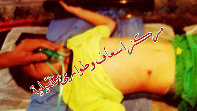 Photo purportedly showing the boy after arriving at the hospital