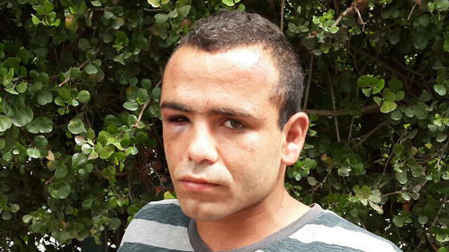 The injured Arab in Netanya. (Photo: Hassan/Shaalan) (צילום: חסן שעלאן) The injured Arab in Netanya. (Photo: Hassan/Shaalan)