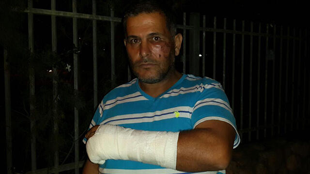Wail Shaalan, injured in a racist attack in Netanya.