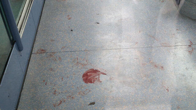 Blood on the floor left by the light rail attack (Photo: Eli Mandelbaum)