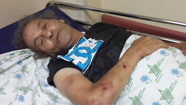 Herzl Rokah at Lanaido Hospitalnullnull Herzl Rokah at Lanaido Hospital