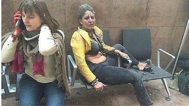 Injured from the explosion at the airport