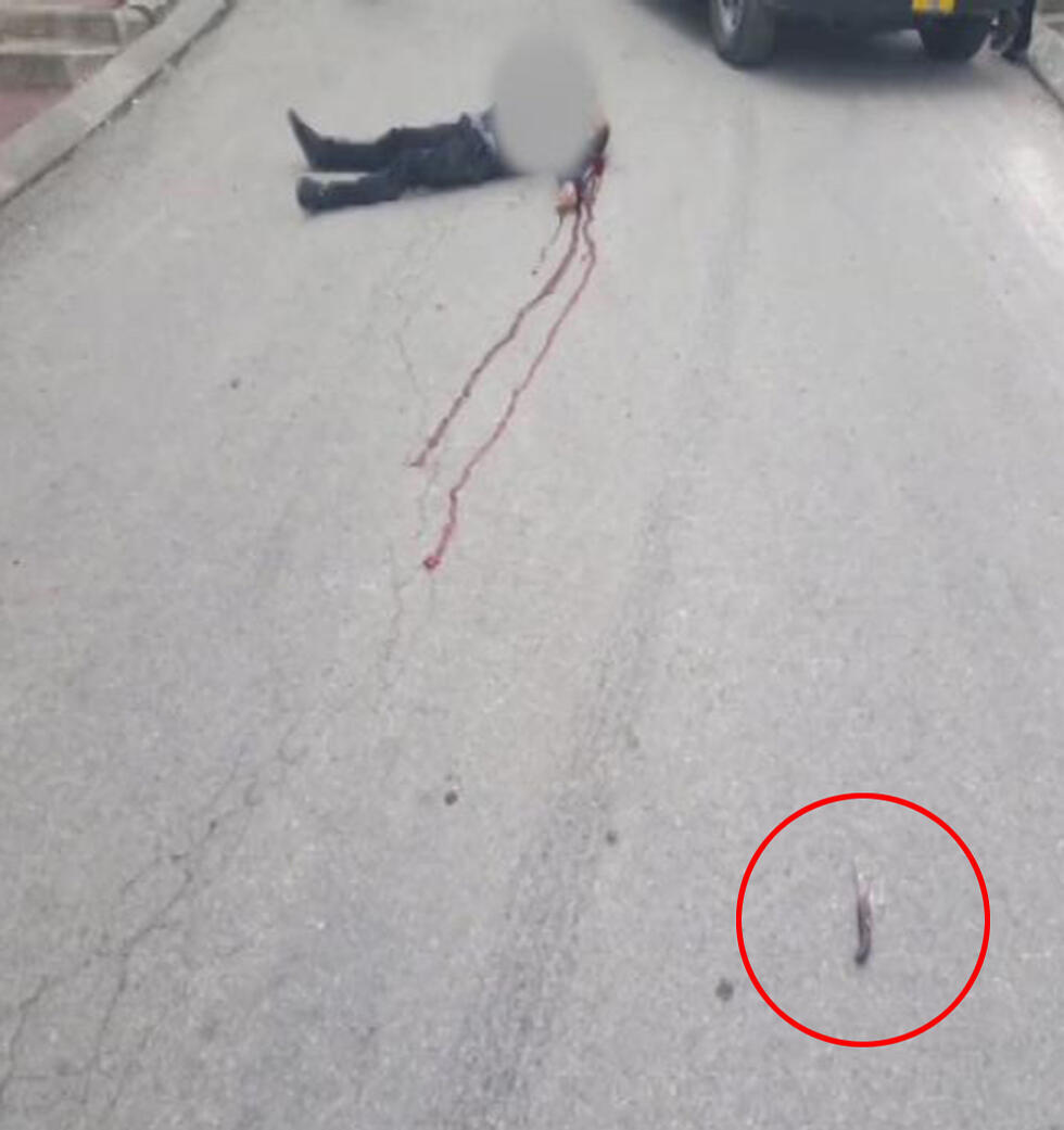 The terrorist and the knife 