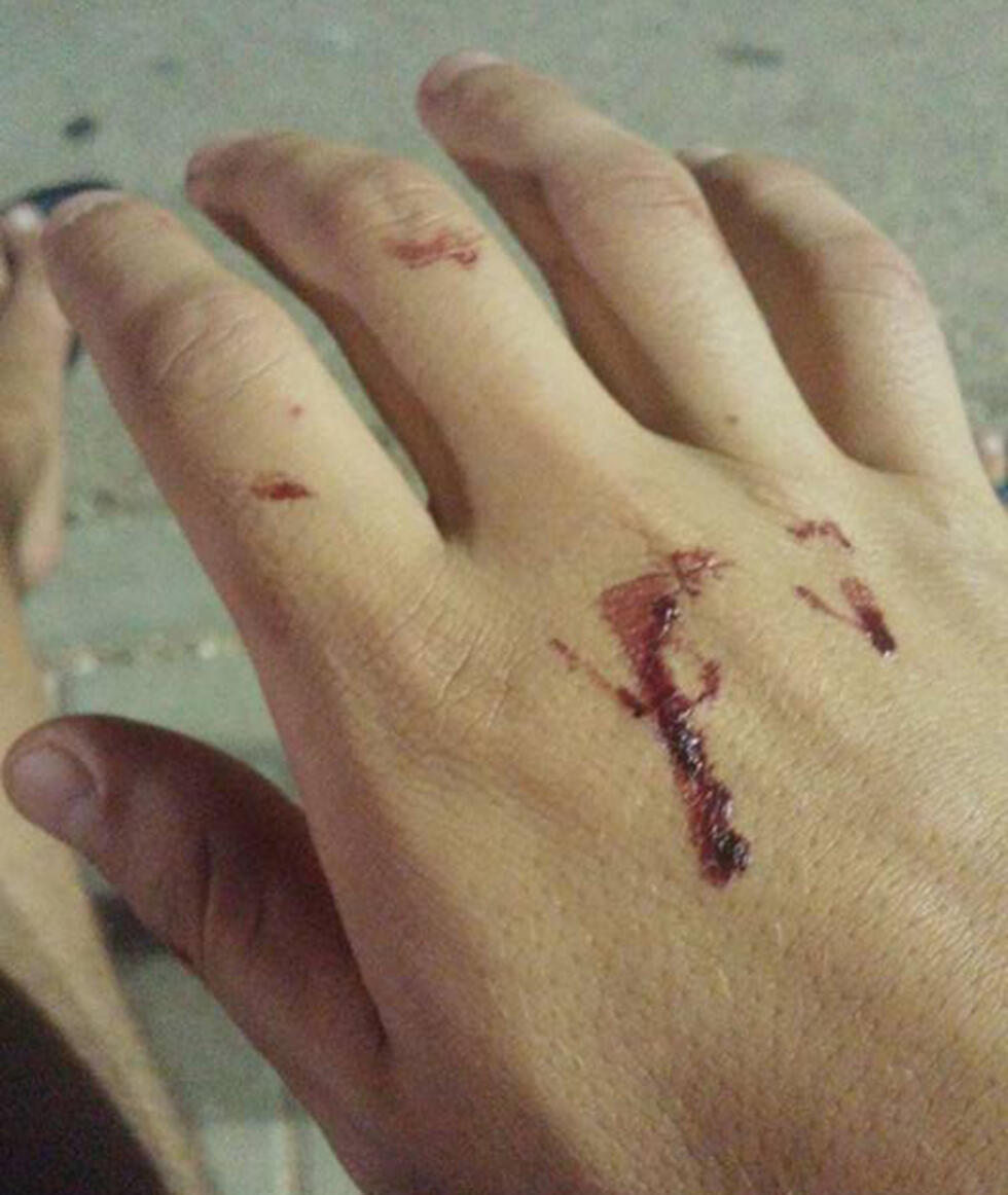 Some of the boy's injuries