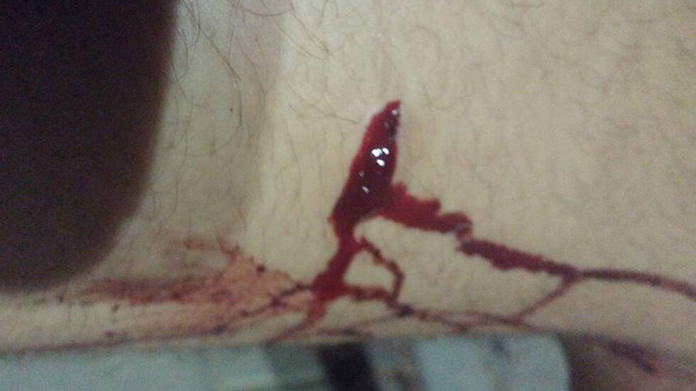 Some of the boy's injuries