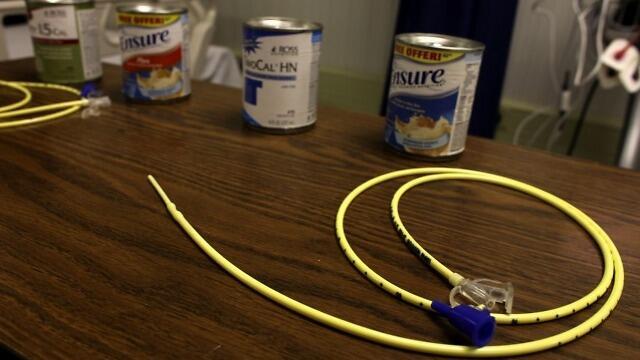 A feeding tube used to force-feed prisoners (Photo: AP)