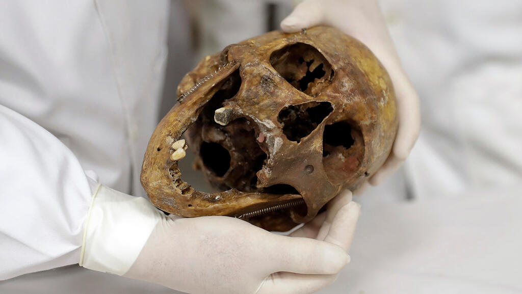Mengele's skull (Photo: AP) Mengele's skull