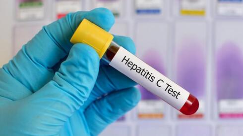 למרות טיפולים יעילים, עדיין אין כיום חיסון נגד נגיף הפטיטיס C