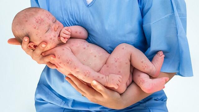 Фото: shutterstock
