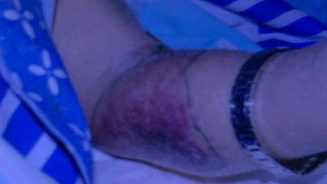 Пожилой человек в доме престарелых с признакам избиения. Фото: пресс-служба полиции