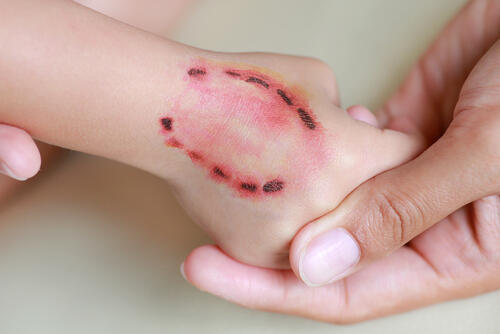 Фото: shutterstock