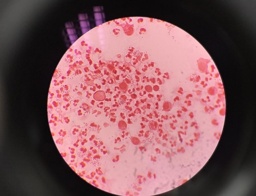 Бактерии гонореи. Фото: shutterstock