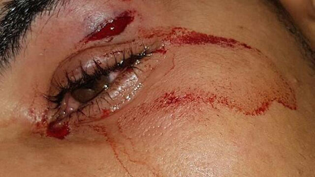 Picture taken of one of the soldiers who was attacked