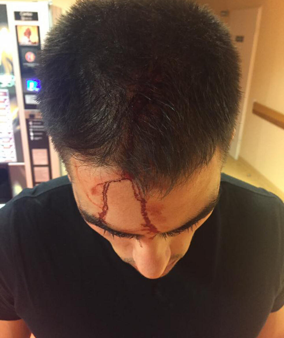Cohen was attacked by an Egyptian man in a bar (Photo: Eli Cohen)