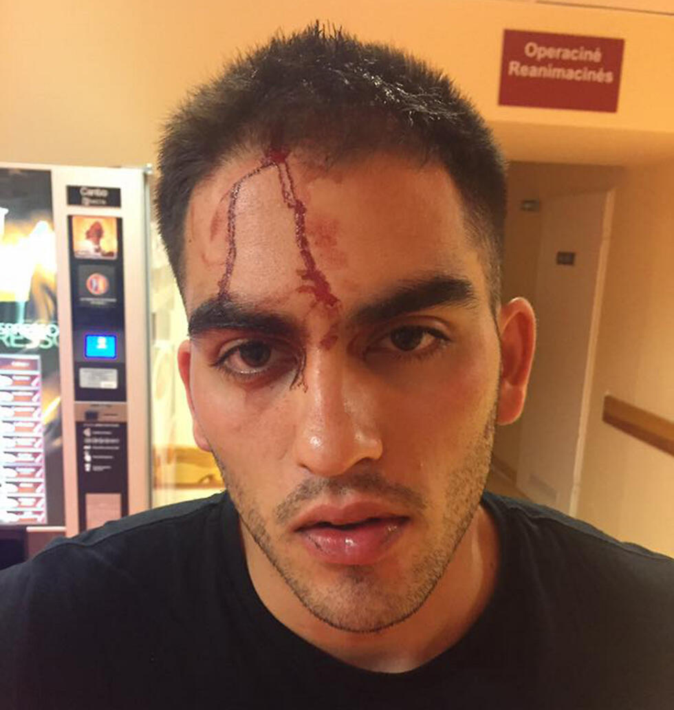 Student Eli Cohen showing the aftermath of the anti-Semitic attack (Photo: Eli Cohen)
