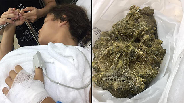 Лихи и рыба-камень. Фото со страницы Рути Липскин-Сандлер в фейсбуке (צילום: מתוך הפייסבוק של רותי ליפסקין סנדלר) Лихи и рыба-камень. Фото со страницы Рути Липскин-Сандлер в фейсбуке