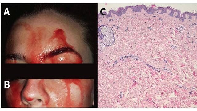 Фото: Canadian Medical Association Jurnal