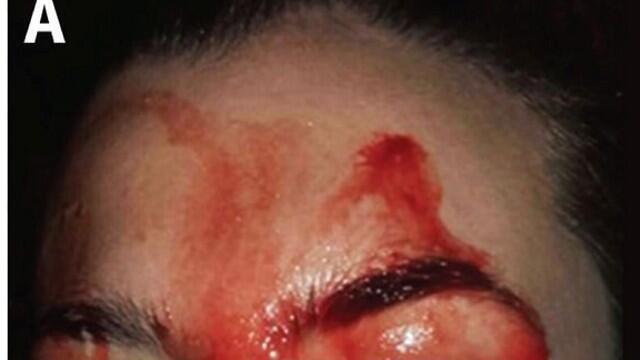 Фото: Canadian Medical Association Jurnal