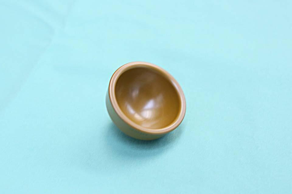 Имплантат из материала для НАСА. Фото: Петр Флитер ("Рамбам") (Фото: Петр Флитер ("Рамбам")) Имплантат из материала для НАСА. Фото: Петр Флитер ("Рамбам")