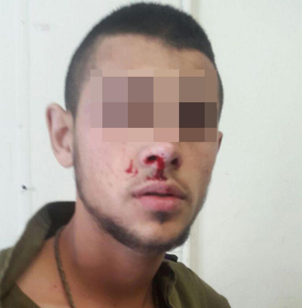 Пострадавшийnullnull Пострадавший