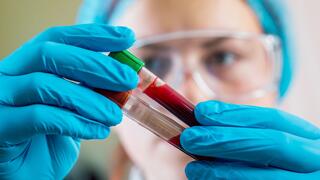 The new blood test is designed to help diagnose Alzheimer’s in people age 40 and older with cognitive symptoms 