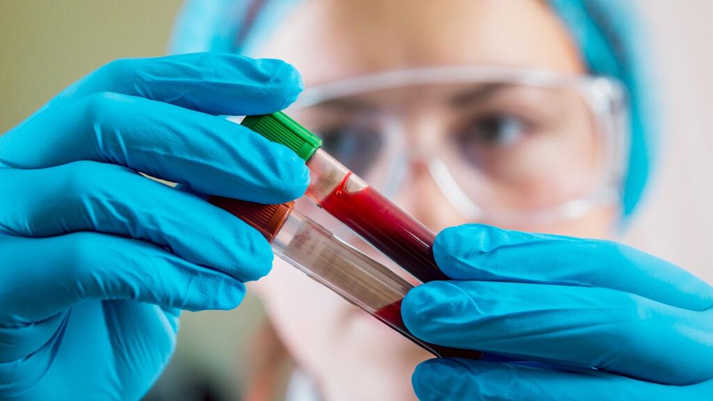 The new blood test is designed to help diagnose Alzheimer’s in people age 40 and older with cognitive symptoms (Photo: Shutterstock) The new blood test is designed to help diagnose Alzheimer’s in people age 40 and older with cognitive symptoms
