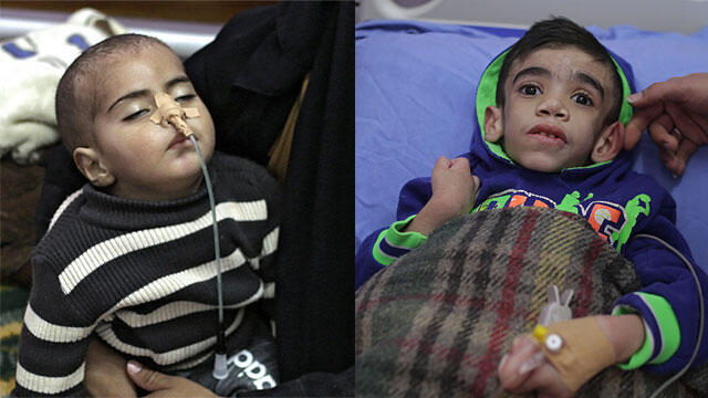 Terminally ill children in Gaza hospitals