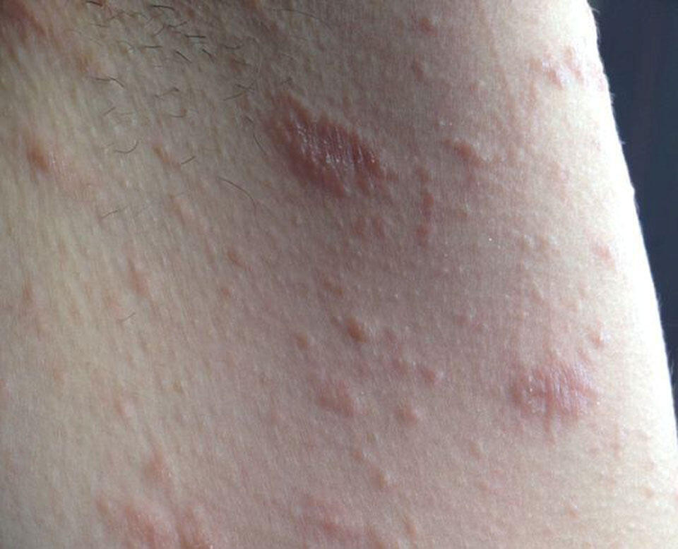 Фото -shutterstock