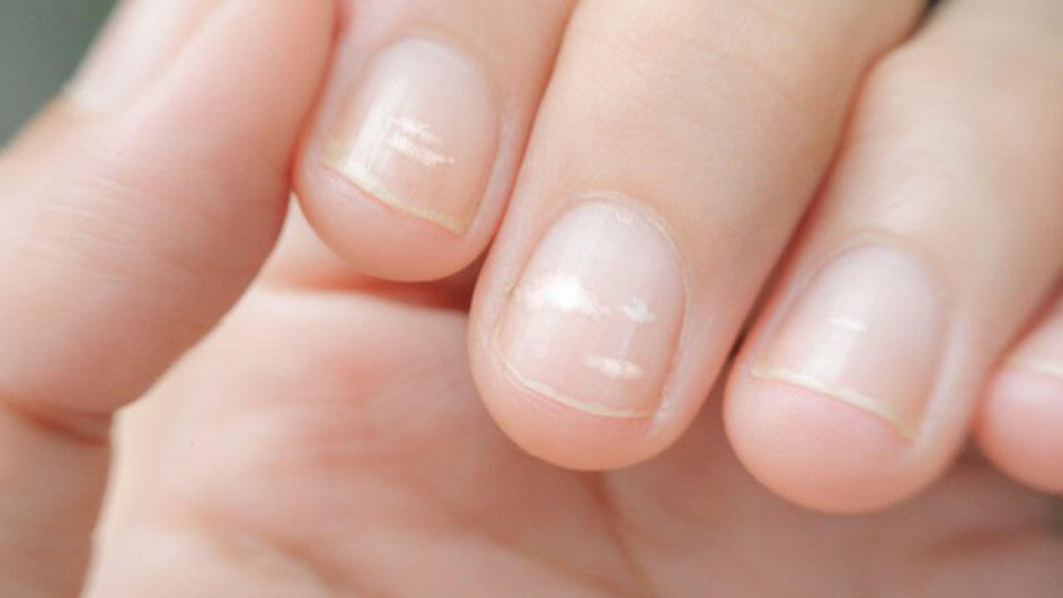 Фото: shutterstock (Фото -shutterstock) Фото: shutterstock