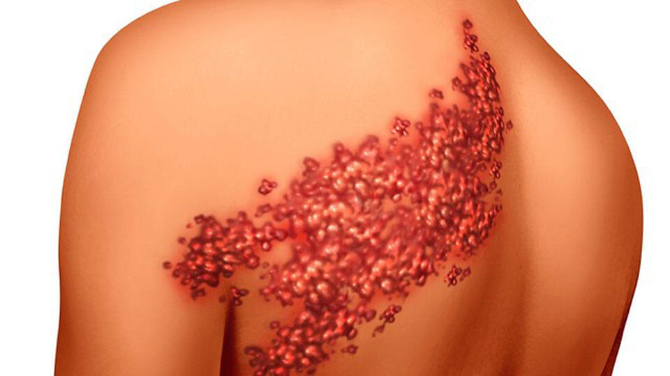 Фото: shutterstock (Фото -shutterstock) Фото: shutterstock