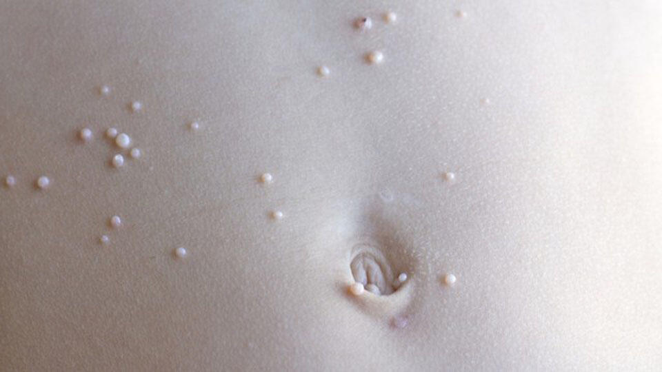 Фото: shutterstock (Фото -shutterstock) Фото: shutterstock