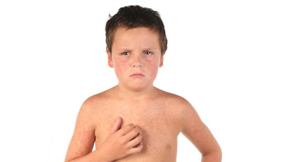 Фото: shutterstock (Фото -shutterstock) Фото: shutterstock