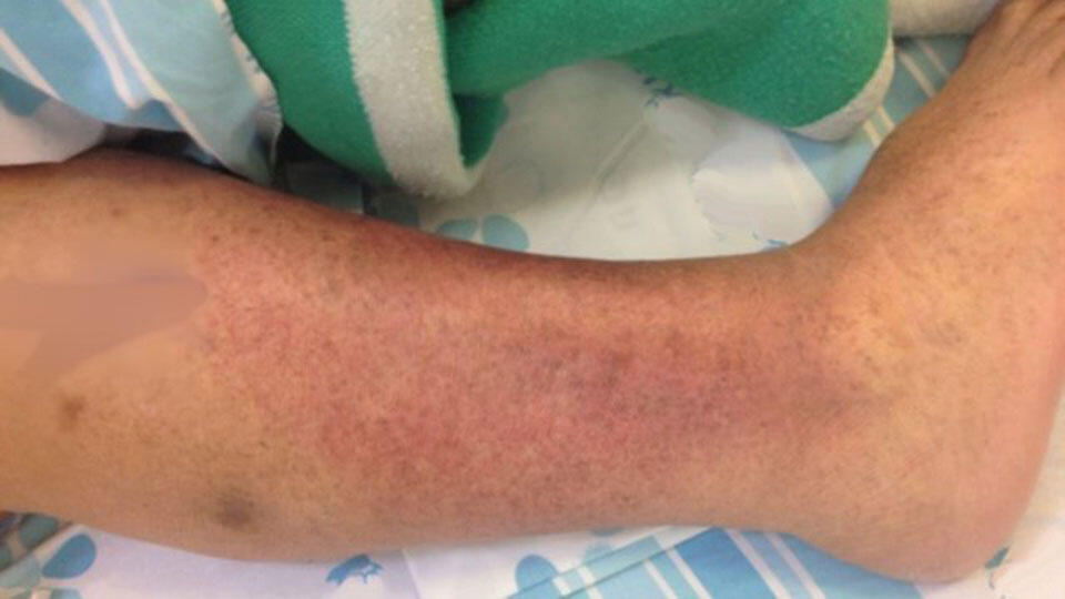 Фото: Эла Эгози (Фото -shutterstock) Фото: Эла Эгози