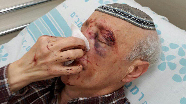 А.Надельсон в больницеnullnull А.Надельсон в больнице