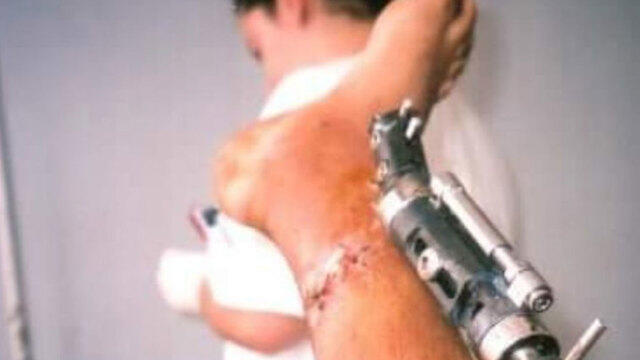 Hadad sustained foot injuriesnullnull Hadad sustained foot injuries