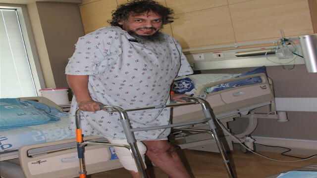  Пациент на своих ногах после введения бактериофагов. Фото: Ран Цабри