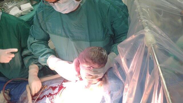 Кесарево сечение через прозрачную перегородку. Фото: "Гамида" (צילום: גאמידה) Кесарево сечение через прозрачную перегородку. Фото: "Гамида"