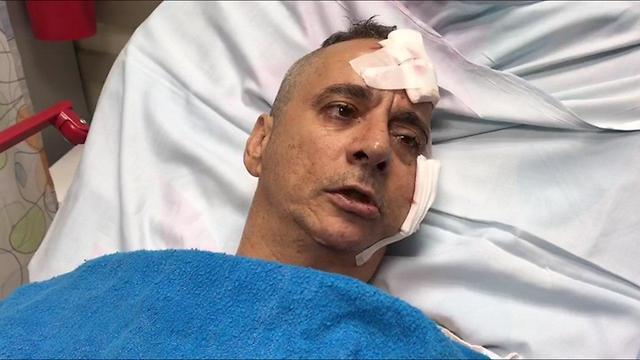 Aharon Buchris who was wounded in rocket hit on his home in Sderot (צילום: בית חולים ברזילי) Aharon Buchris who was wounded in rocket hit on his home in Sderot