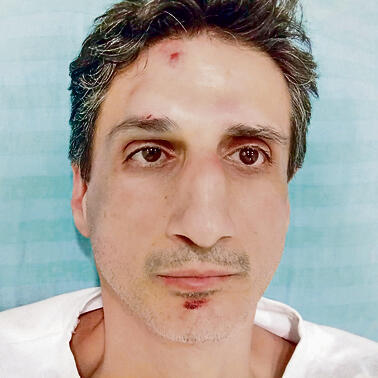 Юрий Илизаров. Фото: "Эгед"