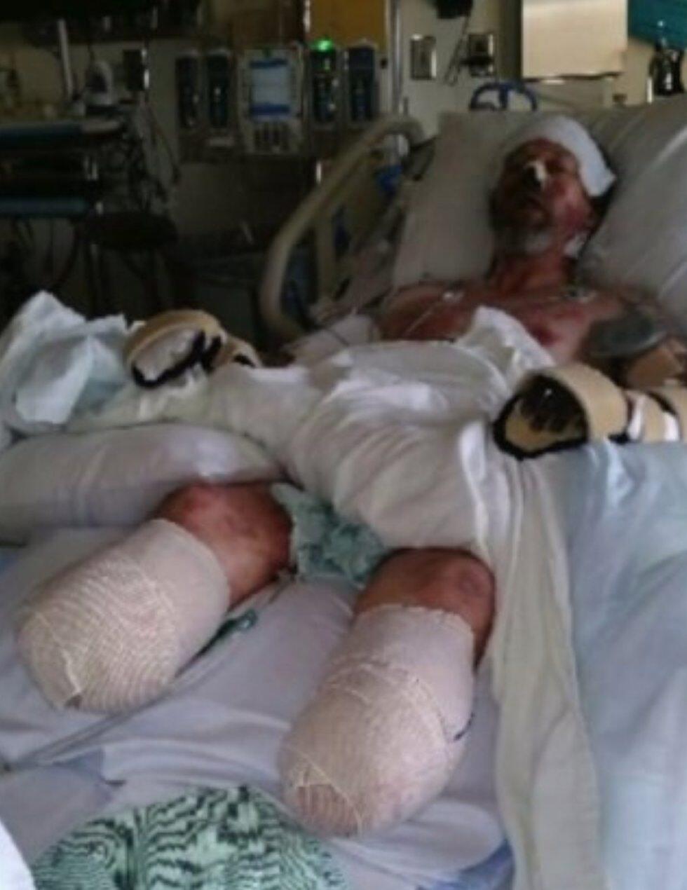 Пострадавший Грег Мантойфель в больнице. Фото: Фото: Fox6v