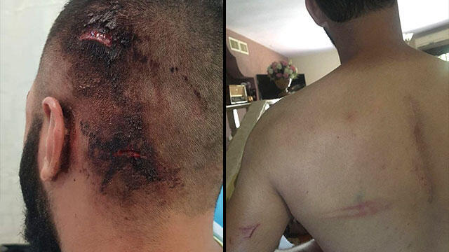 The victims' injuriesnullnull The victims' injuries