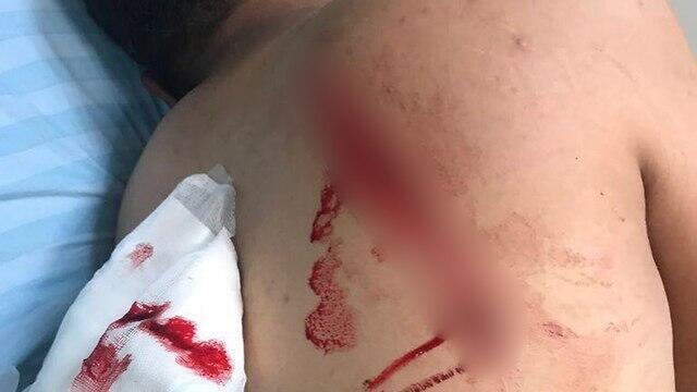 Arabs attacked in Binyamina  