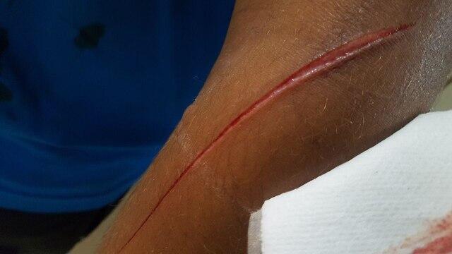     Tayibe resident lightly wounded after being stabbed in hands, face.  