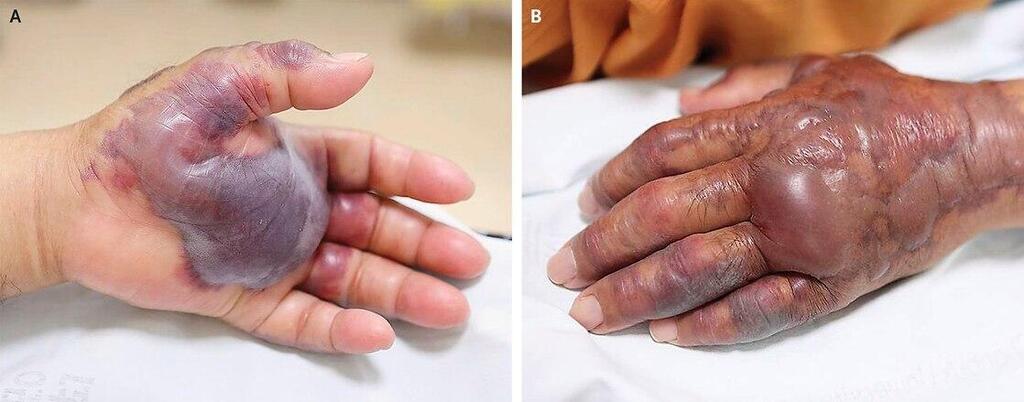 לכתבה! כף יד סושי לכתבה! כף יד סושי